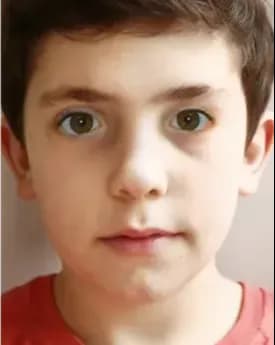 Terapia Digital para Estrabismo Intermitente