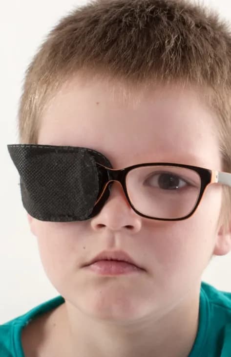 თვალის დაფარვა (პაჩინგი)